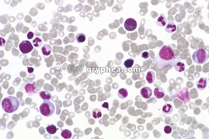 Moelle osseuse x170 - gryphea.com